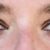 persons face in close up